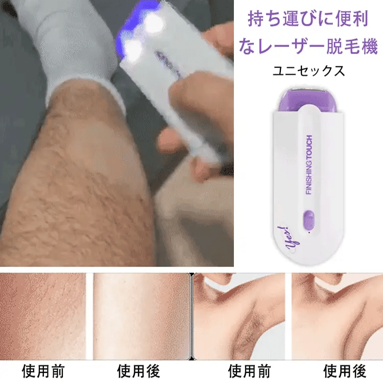 ユニセックス レーザー脱毛機