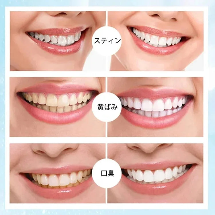 操作が簡単で、歯の表面に残った色素を効果的に洗浄し、歯垢を除去し、歯をもとの白さに戻す