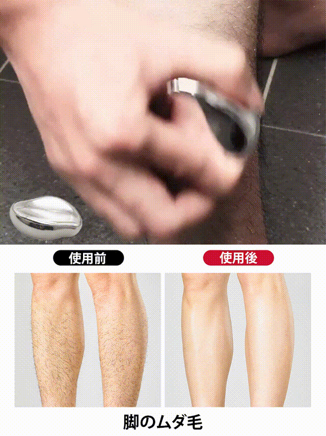 無痛除毛・角質オフつるつるガラス脱毛器