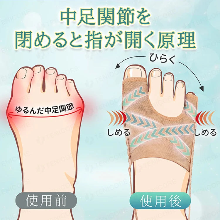 【整形外科専門医推薦】母趾サポーター【30日間で外反母趾、偏平足、足底筋膜炎を徹底改善！】