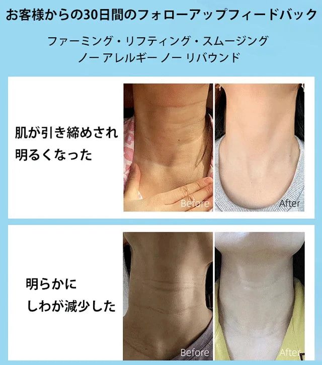 EMS振動ファーミング美顔器