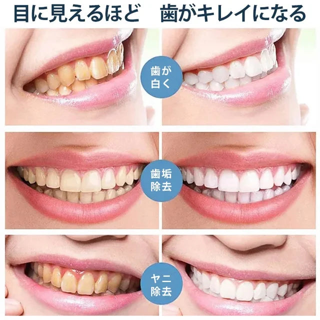 V34セルフホワイトニング剤