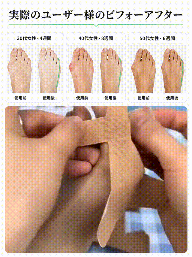 外反母趾サポーター足指サポートバンド